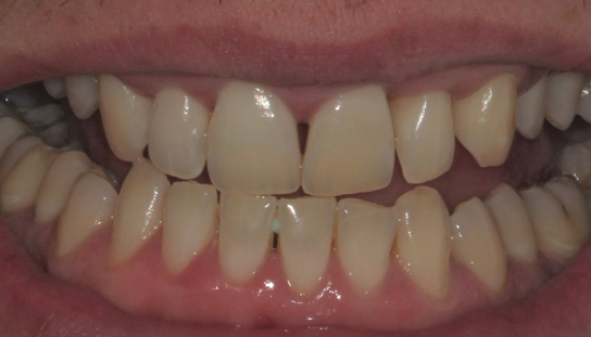 Before - Montpelier Dental Care